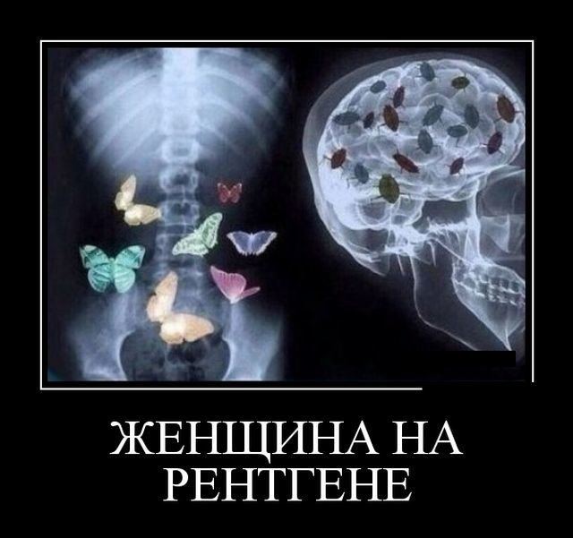 женщина на рентгене